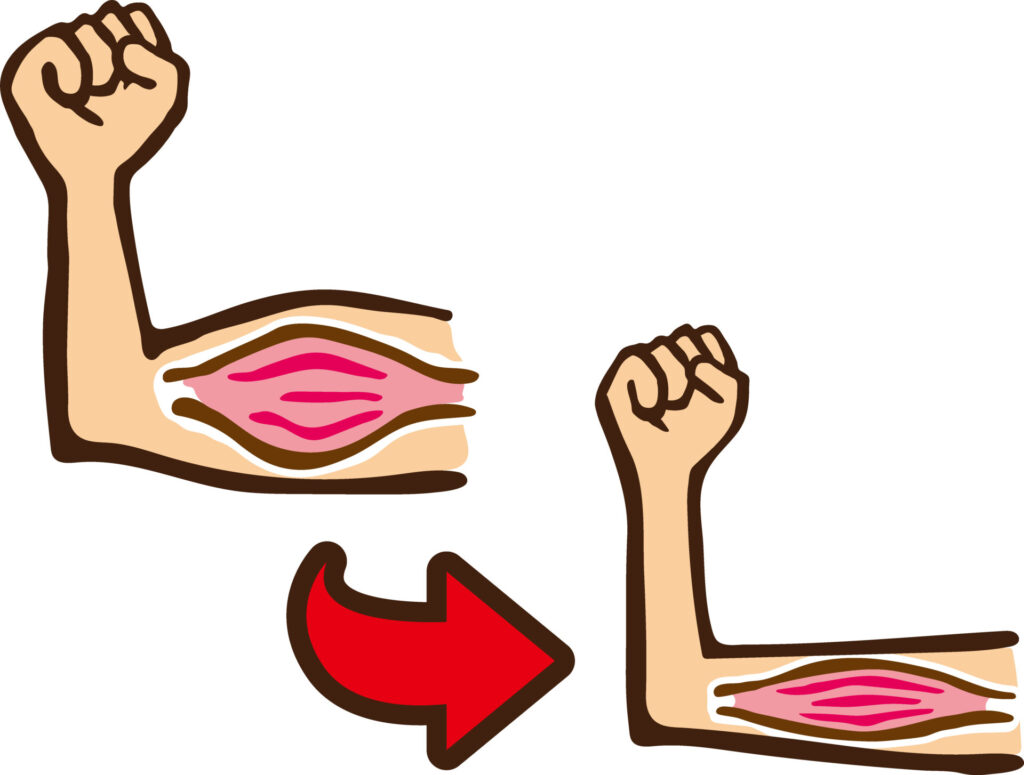 40代以降で痩せにくくなる3つの科学的理由と解決法- 2 サルコペニアにより筋肉が減少する様子