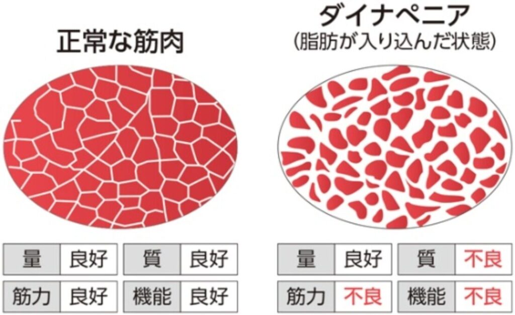 40代以降で痩せにくくなる3つの科学的理由と解決法- 3 正常な筋肉と脂肪が筋肉に入り込んだ状態